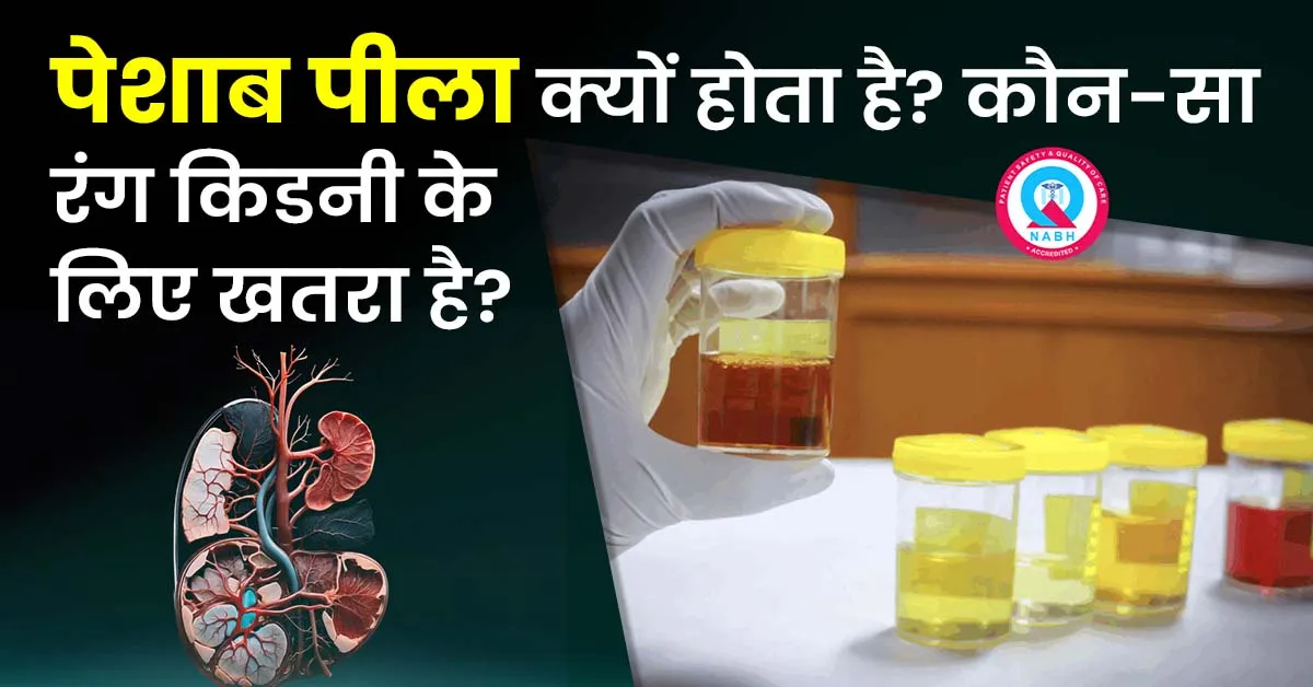 पेशाब-पीला-क्यों-होता-है